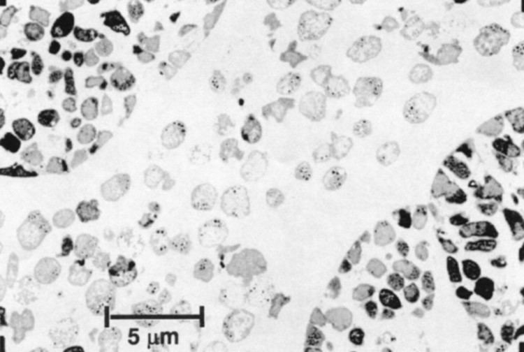 Methanosarcina acetivorans The Genome of M acetivorans Reveals Extensive Metabolic and