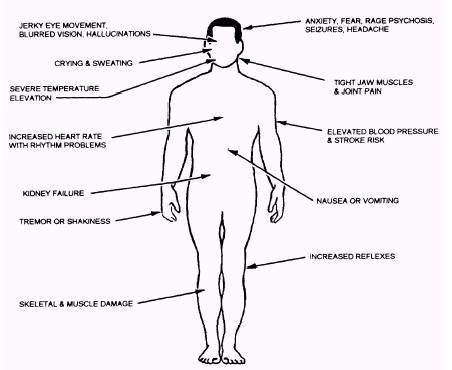 A diagram showing the side effects of Methcathinone on the human body.