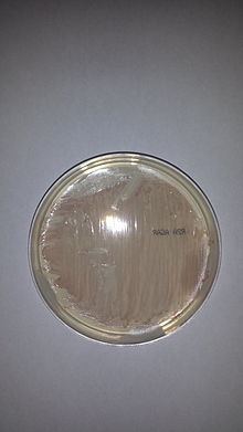 Methylobacterium fujisawaense httpsuploadwikimediaorgwikipediacommonsthu
