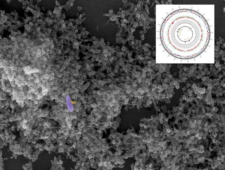 Micavibrio aeruginosavorus Fighting Fire With Fire 39Vampire39 Bacteria Has Potential as Living