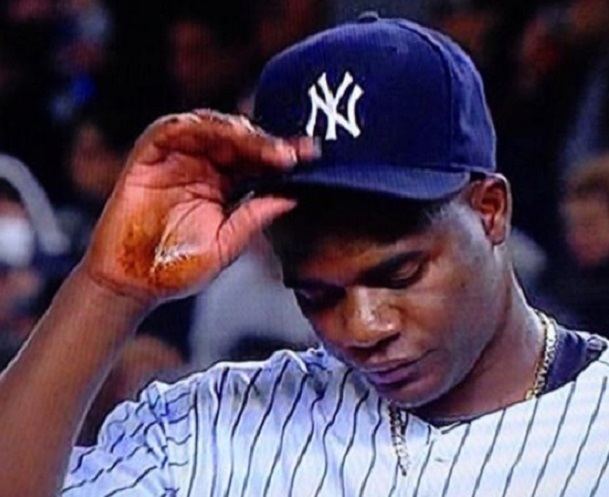 Michael Pineda Captain Obvious Michael Pineda Pine Tar and the Neck Smear That
