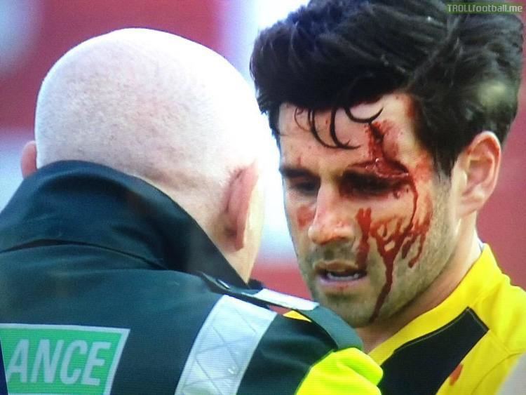 Michael Timlin NSFW Southend midfielder Michael Timlin after a clash of