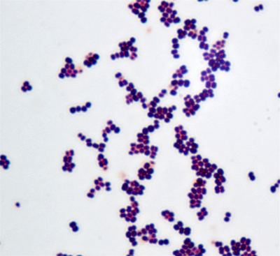Micrococcus Pseudomonas amp Micrococcus