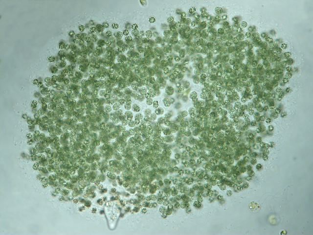 Microcystis Freshwater and other microorganisms from Germany Microcystis