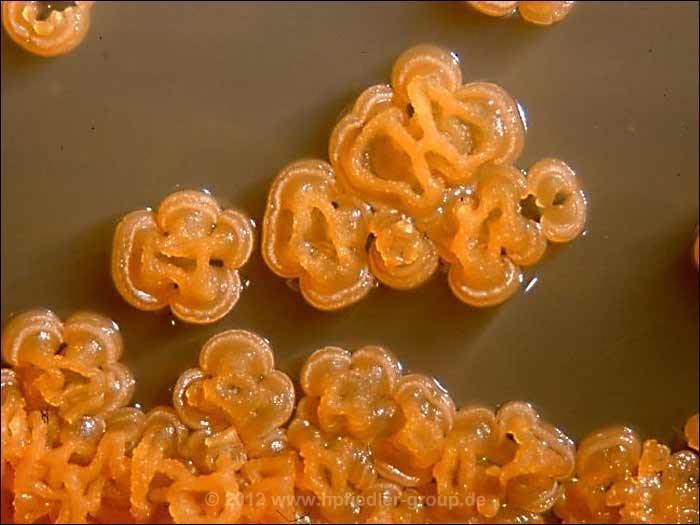 Micromonospora Micromonospora el actinomiceto marino en la lucha contra el cncer