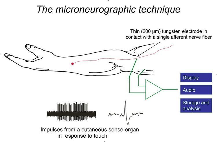 Microneurography