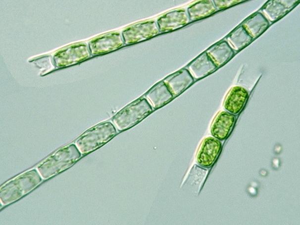 Microspora protistihoseiacjpPDBImagesChlorophytaMicro