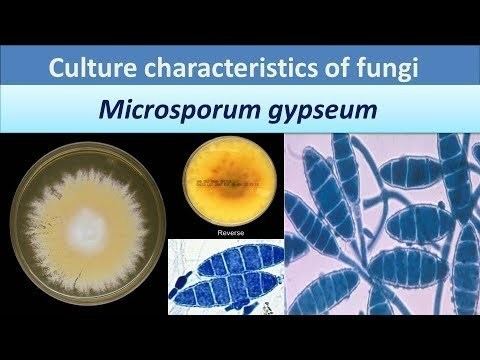 Microsporum gypseum.(Clear over view about Colony morphology). - YouTube