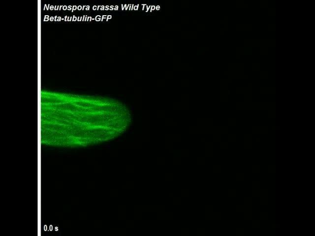 Microtubule plus-end tracking protein