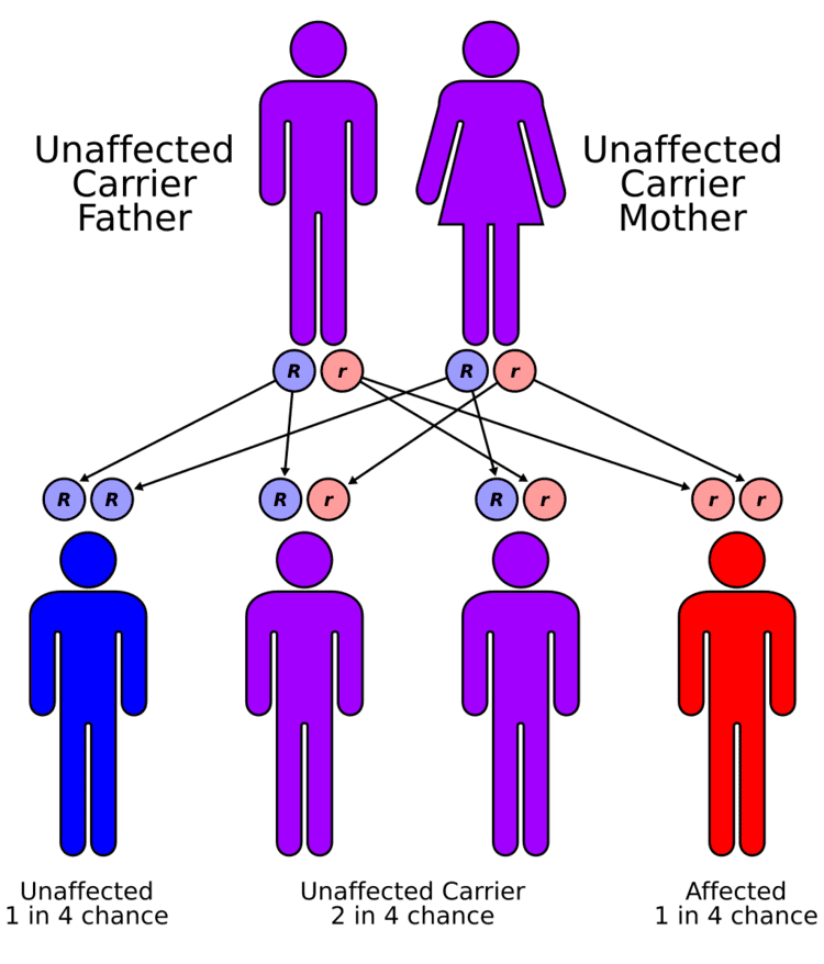 Microvillous inclusion disease
