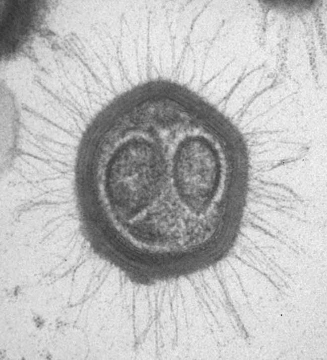 Mimivirus New Virus Defies Classification