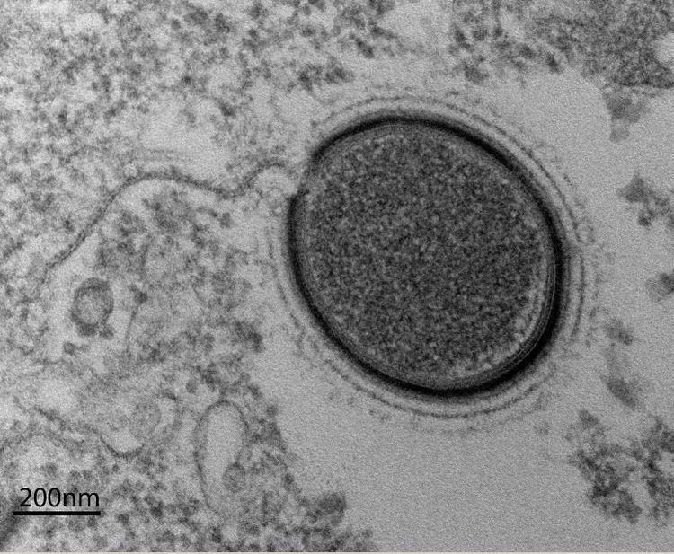 Mollivirus Frozen Giant Virus Still Infectious After 30000 Years