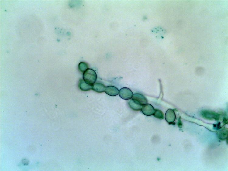Monilinia Monilinia fructicola Microscope Talk