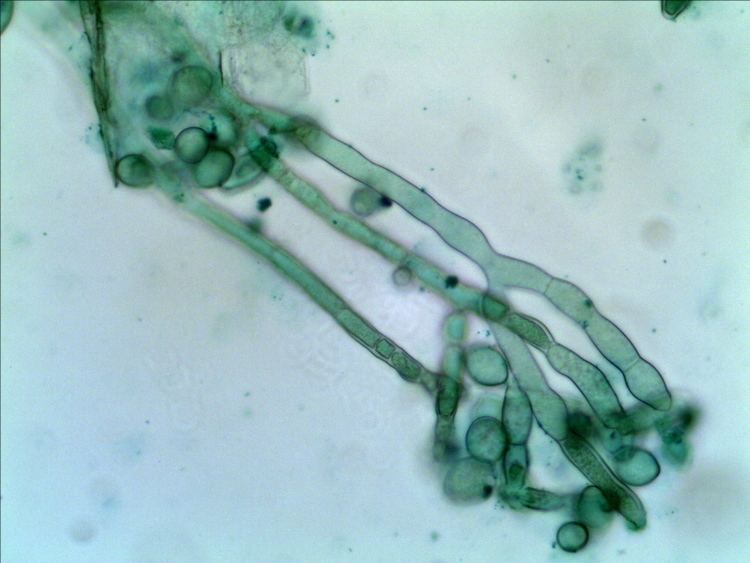 Monilinia fructicola Monilinia fructicola Microscope Talk