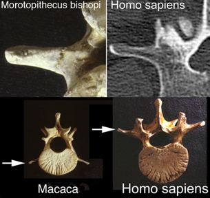 Morotopithecus Morotopithecus amp Homo sapiens vertebrae Anthropologynet