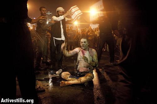 Moshe Silman Israeli Lights Himself on Fire After Thousands March on