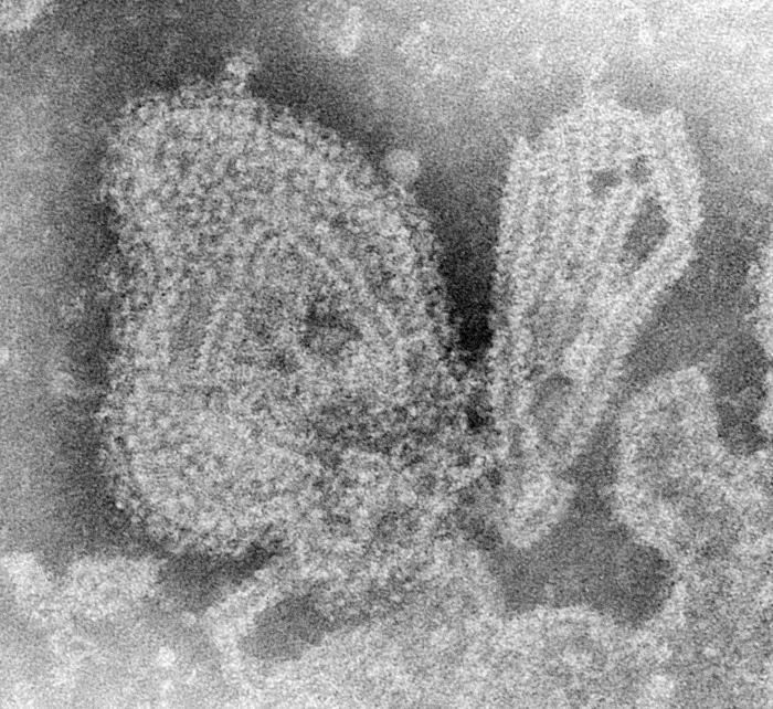 Mumps virus Mumps Viruses Pathogen Profile Dictionary