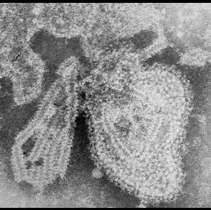 Mumps virus Mumps virus Wikipedia