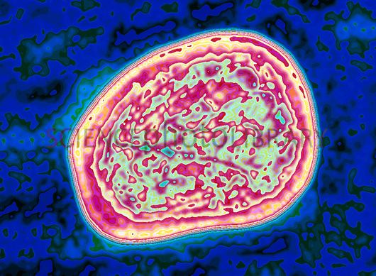 Mumps virus TEM of mumps virus Rabula inflans Stock Image M0500495 Science