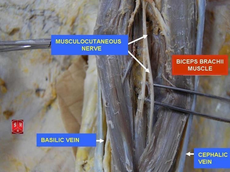 Musculocutaneous nerve