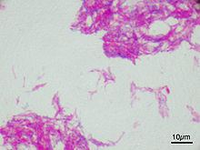 Mycobacterium bovis httpsuploadwikimediaorgwikipediacommonsthu