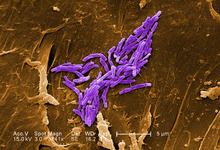 Mycobacterium fortuitum httpsuploadwikimediaorgwikipediacommonsthu