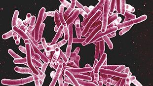 Scanning electron micrograph of Mycobacterium tuberculosis bacteria, which cause TB