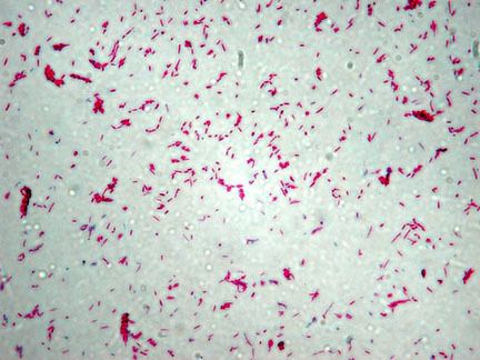 Acid fast stain of Mycobacterium smegmatis cells