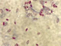 Mycobacterium smegmatis