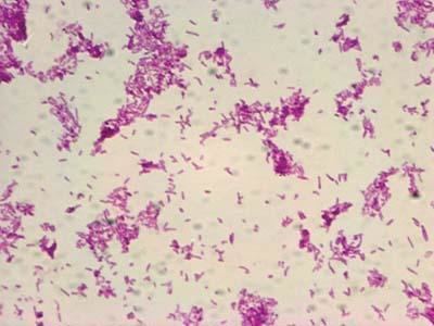 Acid fast stain of Mycobacterium smegmatis cells
