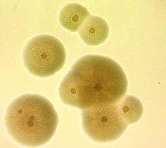 Mycoplasma gallisepticum cevruconnedumycgalljpg