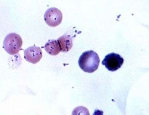 Mycoplasma haemofelis as seen in a microscope.