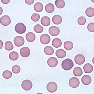 Mycoplasma haemofelis as seen in a microscope.