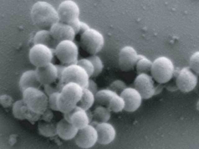 Mycoplasma mycoides Scientists made a living cell entirely controlled by synthetic DNA