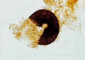 Mycosphaerella citri wwwipmorgcnbcscB030106T2JPG