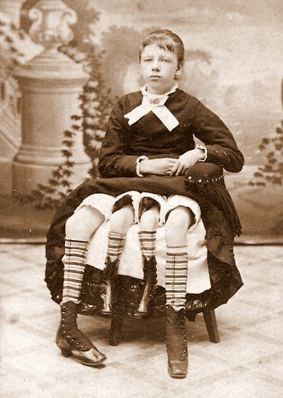 Myrtle Corbin as a girl sitting down with her Dipygus wearing a black dress along with striped socks and black boots.