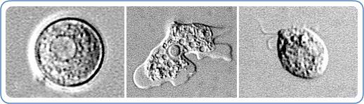 Naegleria Primary Amebic Meningoencephalitis PAM Naegleria fowleri CDC