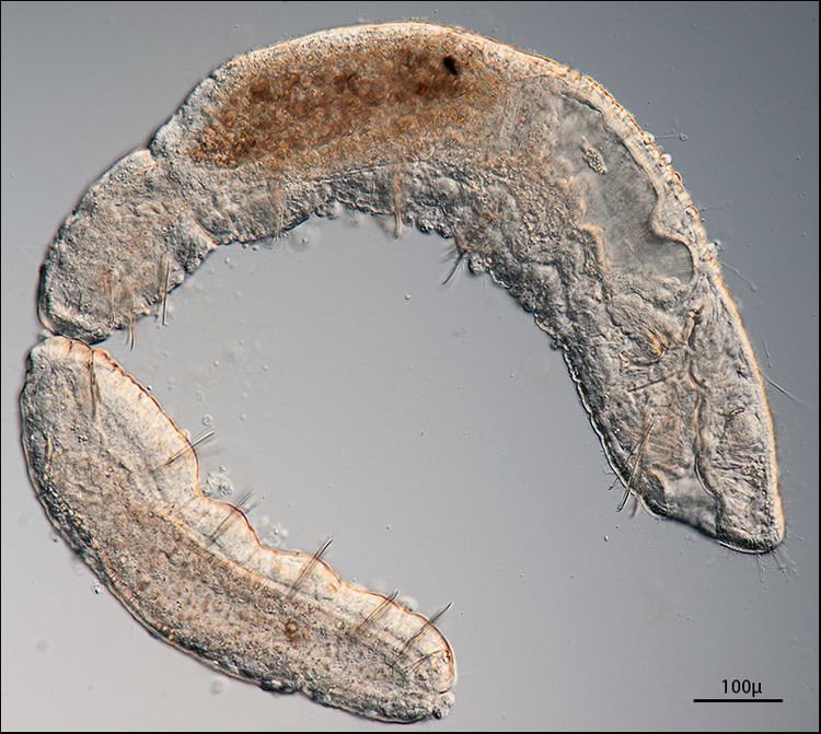 Naididae wwwphotomacrographynet View topic Chaetogaster a FW worm