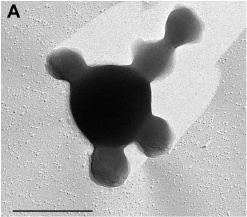 Nanoarchaeota Nanoarchaeum MicrobeWiki