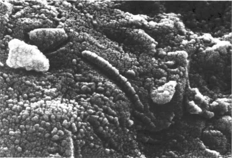 Nanobacterium