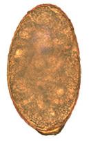 Nanophyetus salmincola httpsuploadwikimediaorgwikipediacommonscc