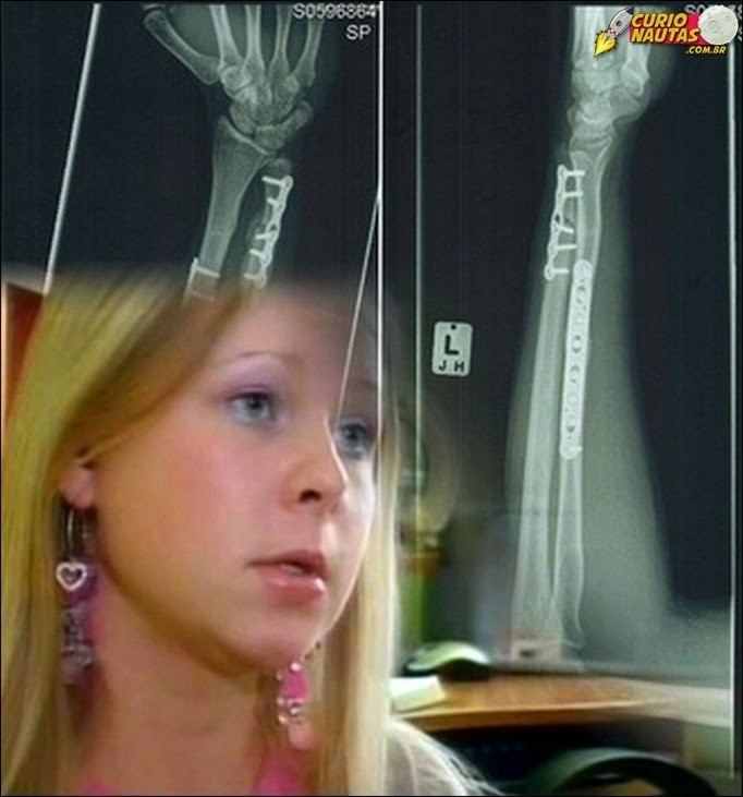 Natasha Demkina with an x-ray in her eyes and can see the inside of a human body