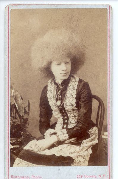 Nellie Walker Nellie Walker Albino Girl Circassian Beauties Pinterest