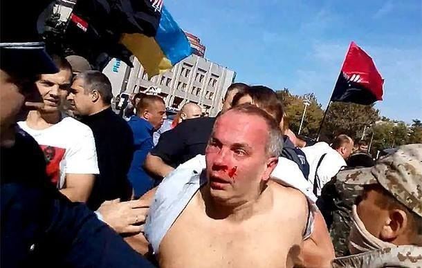 Nestor Shufrych was beaten by a mob in Odesa, Ukraine while the local police are helping him. Nestor is topless with blood on his face.