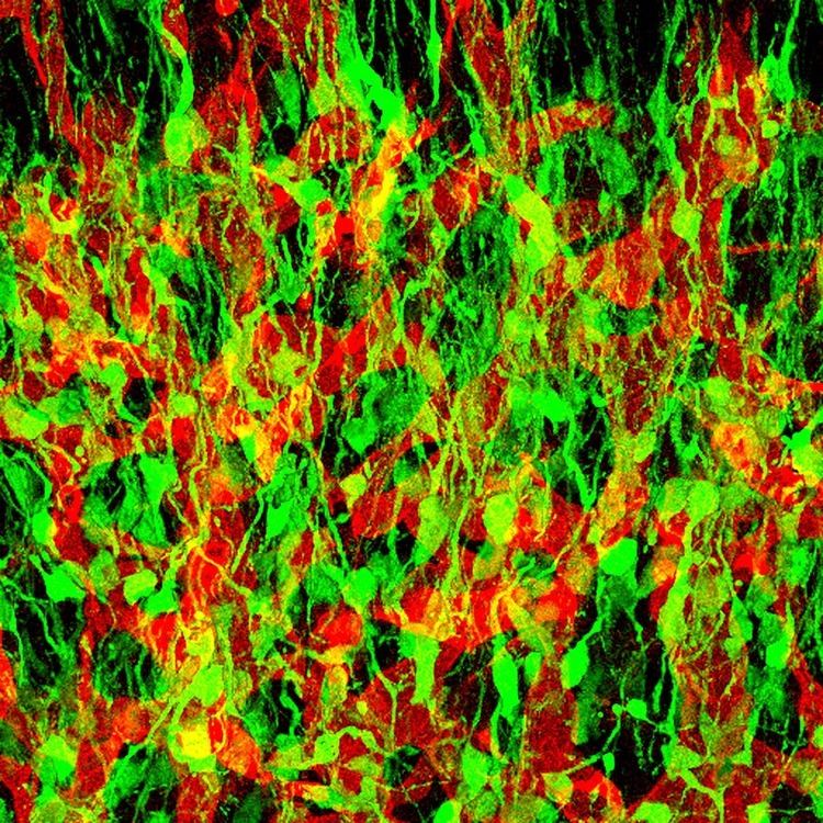 Neural stem cell