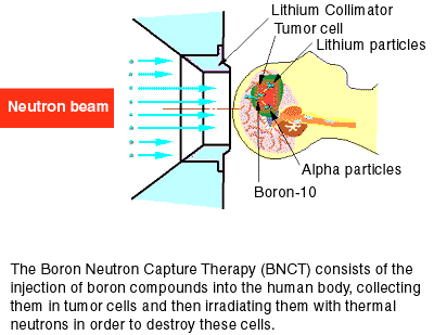 Neutron capture therapy of cancer Neutron Capture Therapy BNCT