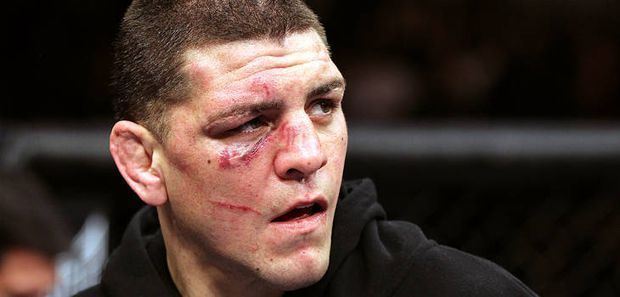 Nick Diaz UFC star Nick Diaz arrested on DUI charges for the second