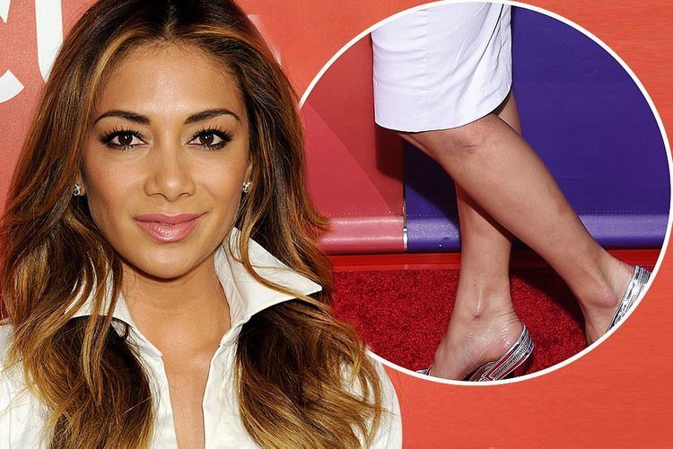 Nicole Scherzinger Nicole Scherzinger is back on form as she puts heartbreak