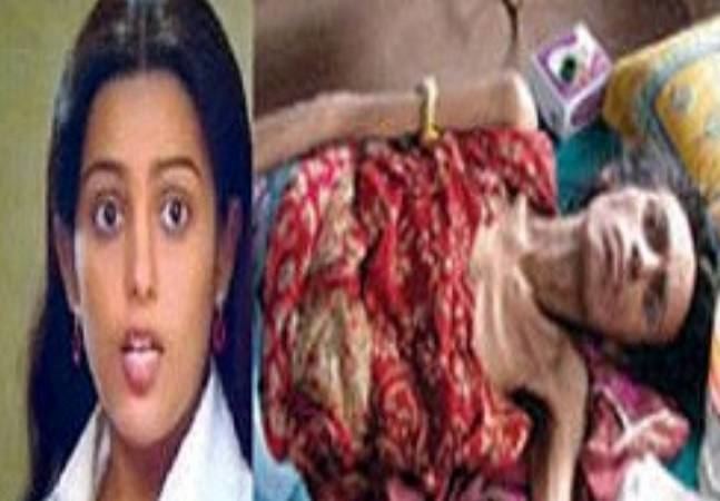 On the left Nisha Noor wearing white blouse and on the right Nisha Noor while suffering from aids