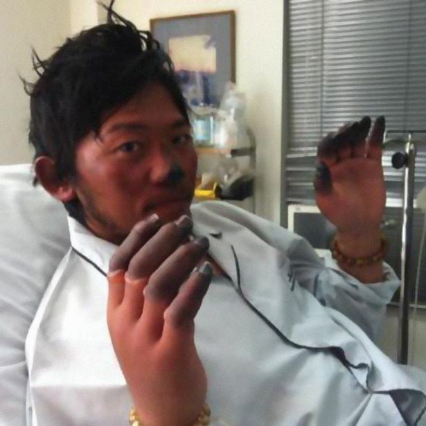 Nobukazu Kuriki Japanese climber with just ONE finger is set to reach